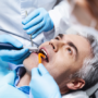 Root canal treatment